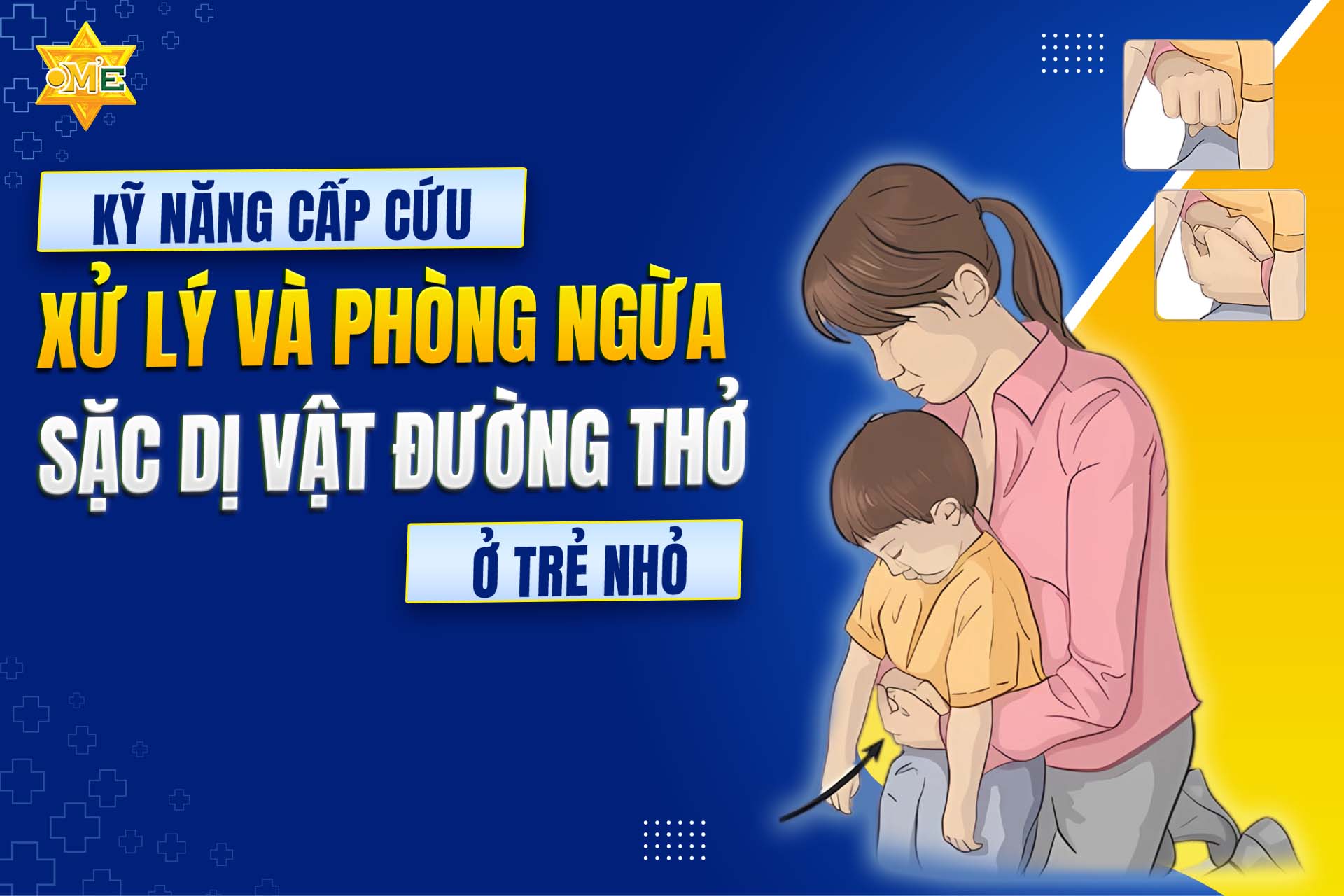 Khóa học kỹ năng cấp cứu, xử lý và phòng ngừa sặc dị vật đường thở ở trẻ nhỏ