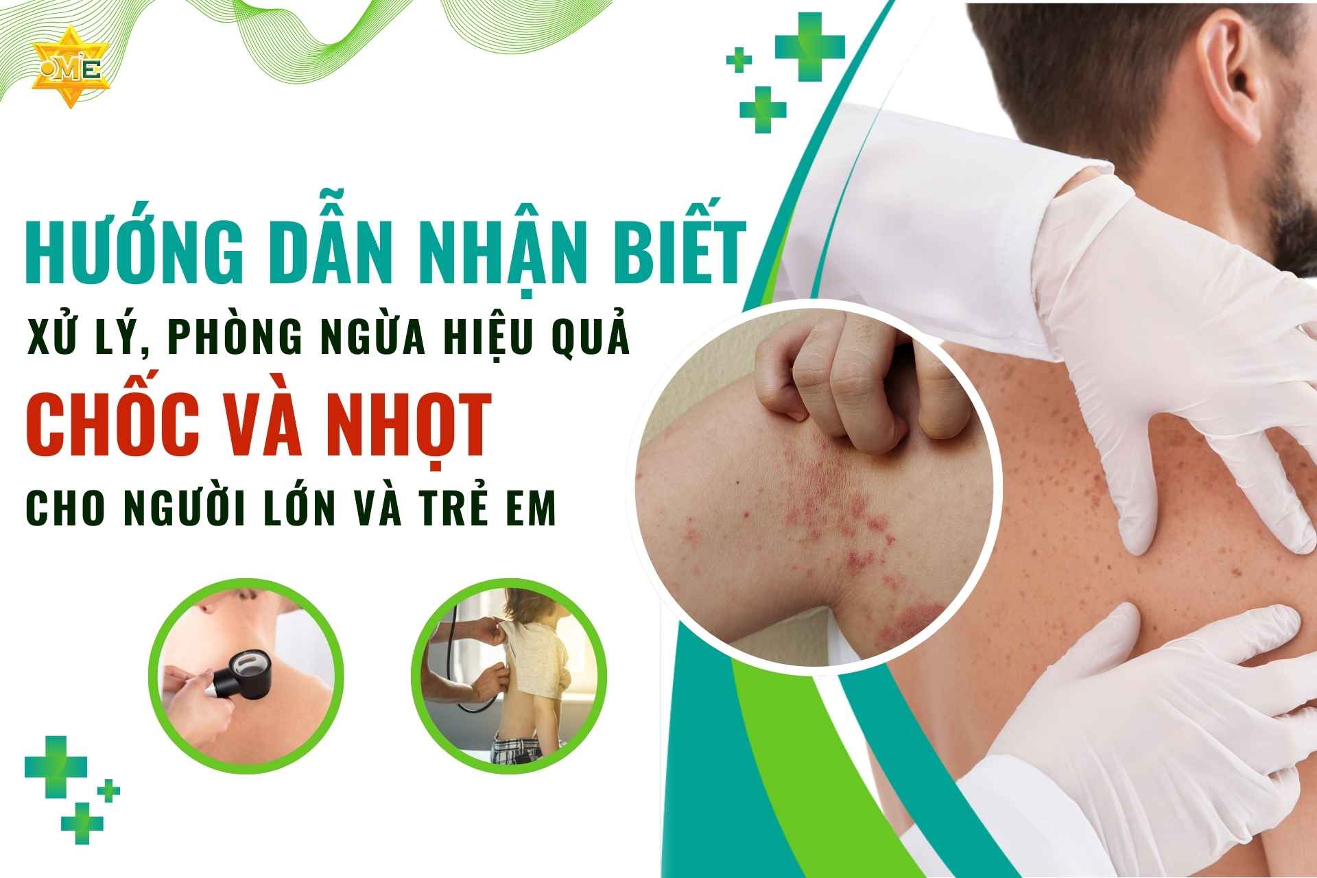 Hướng dẫn nhận biết, xử lý, phòng ngừa hiệu quả chốc và nhọt cho người lớn và trẻ em