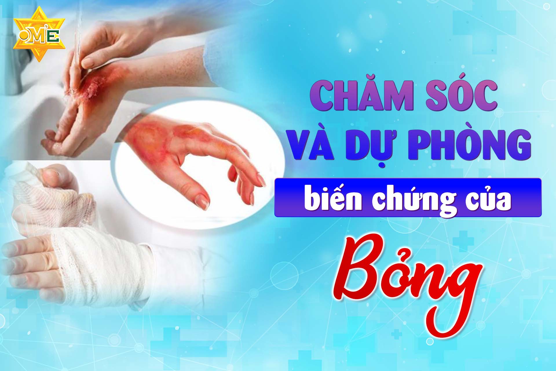 Chăm sóc và dự phòng biến chứng của bỏng