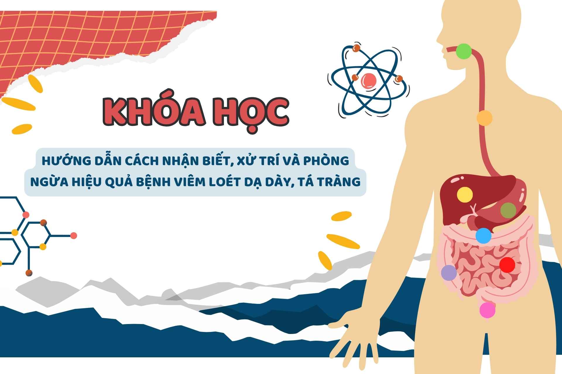 Hướng dẫn cách nhận biết, xử trí và phòng ngừa hiệu quả bệnh viêm loét dạ dày, tá tràng