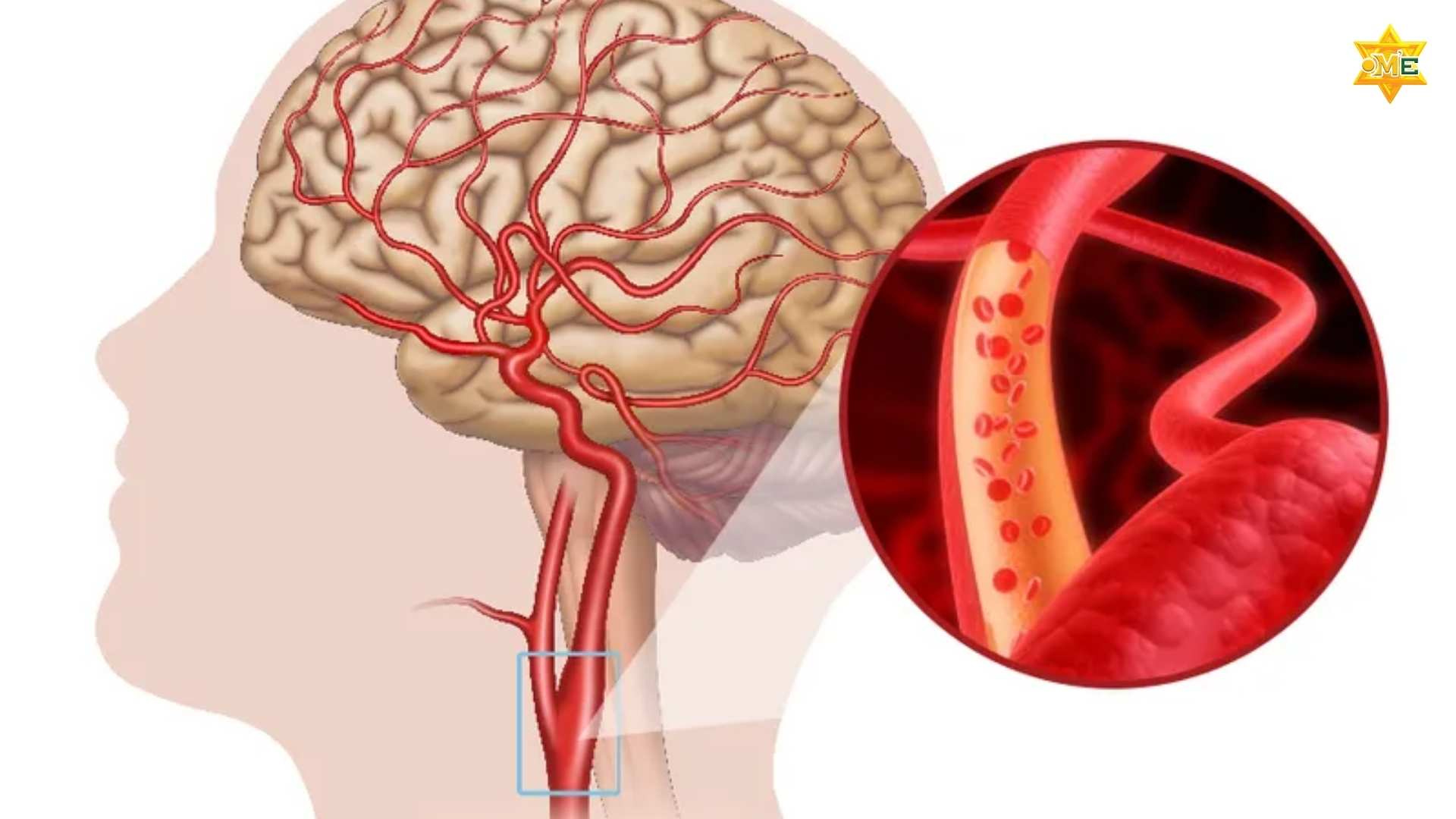 Hướng Dẫn Xoa Bóp Lưu Thông Máu
